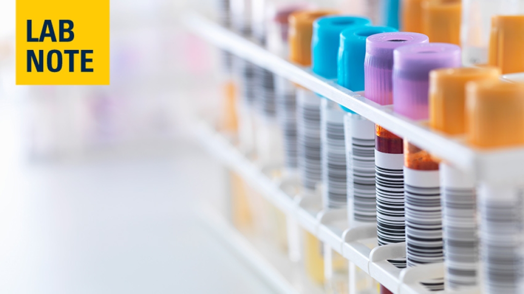 blood vials colorful lab notes
