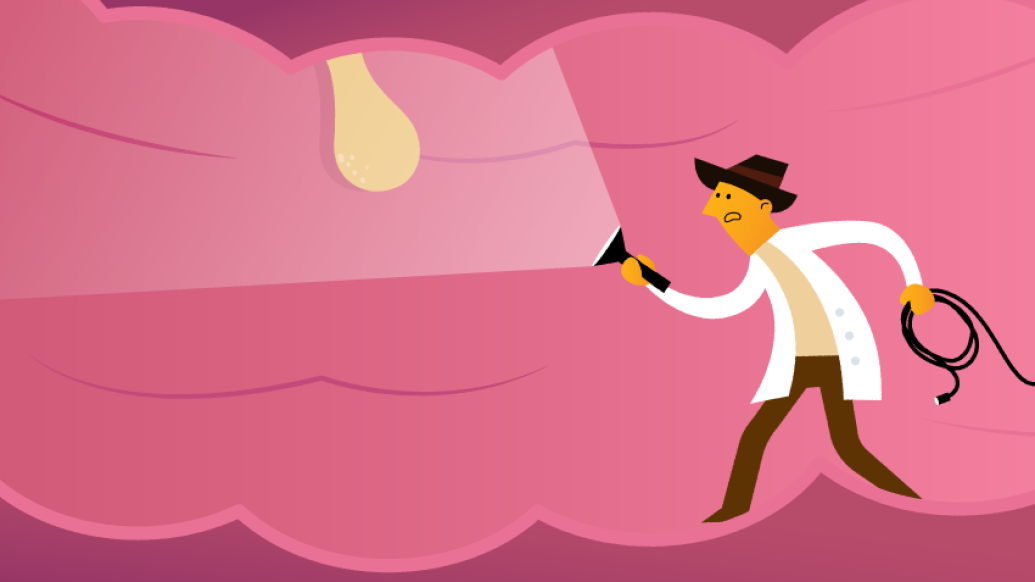 doctor in colon with flashlight and polyp