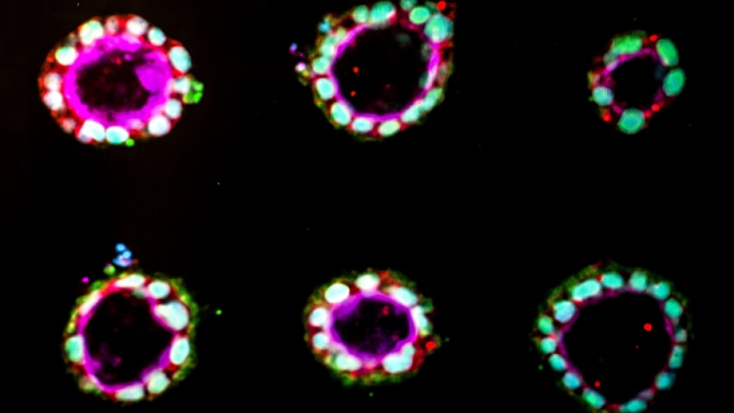 Image of amniotic sac tissue created from human stem cells