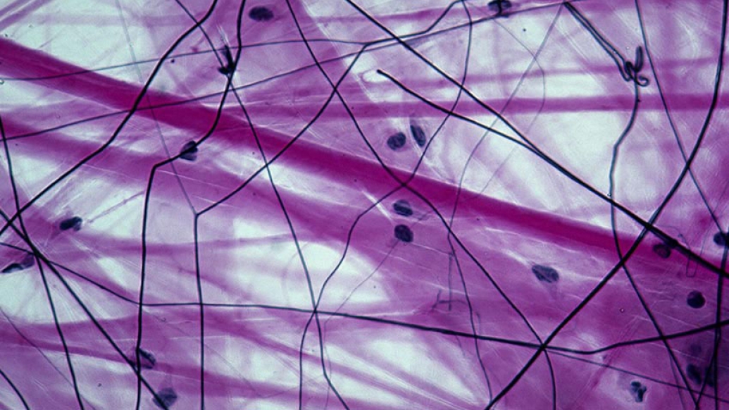 Connective tissue slide