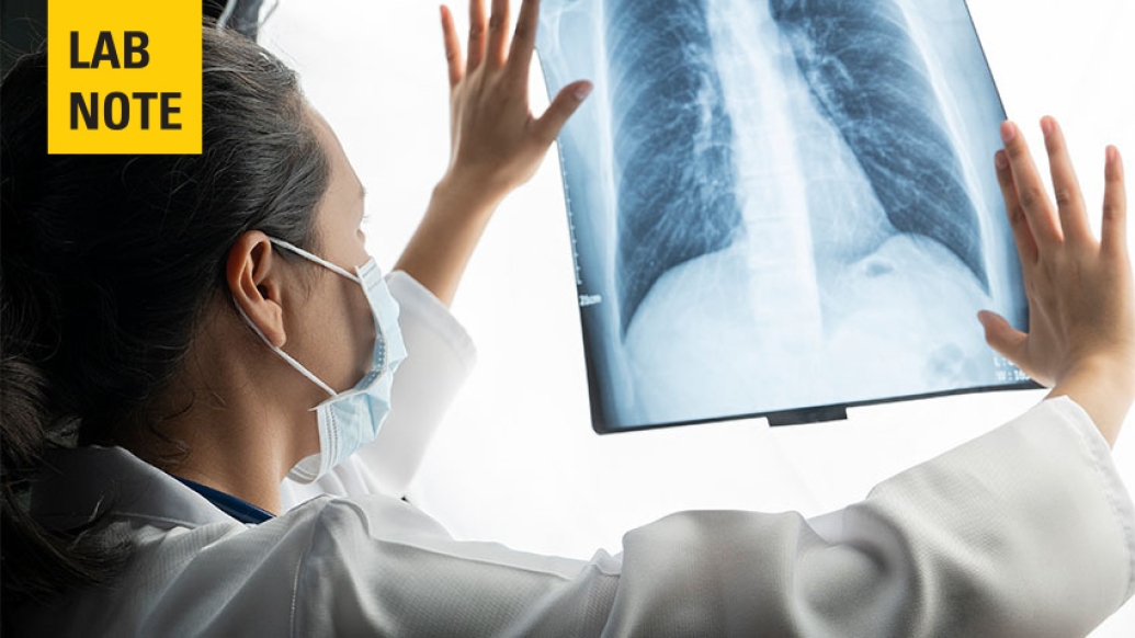 women doc looking ay xray up on bright board