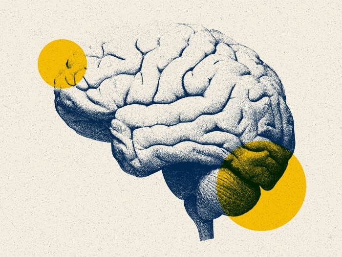 brain drawing blue grey shading yellow spots