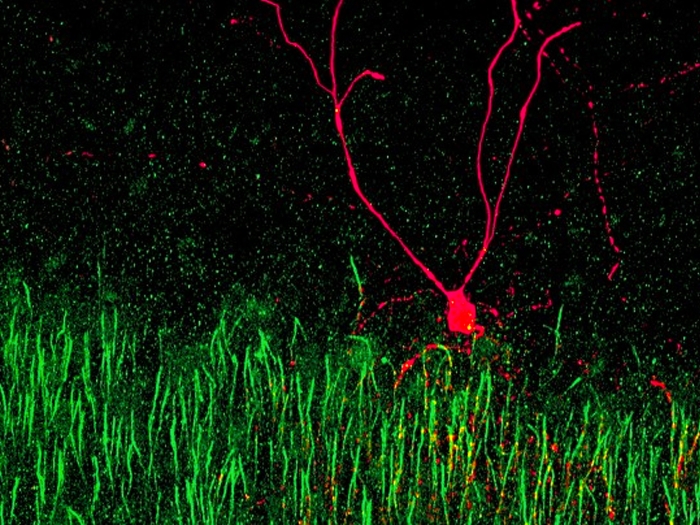 red cell image with green lines