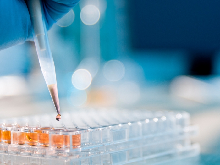 gloved hand doing microplate samples