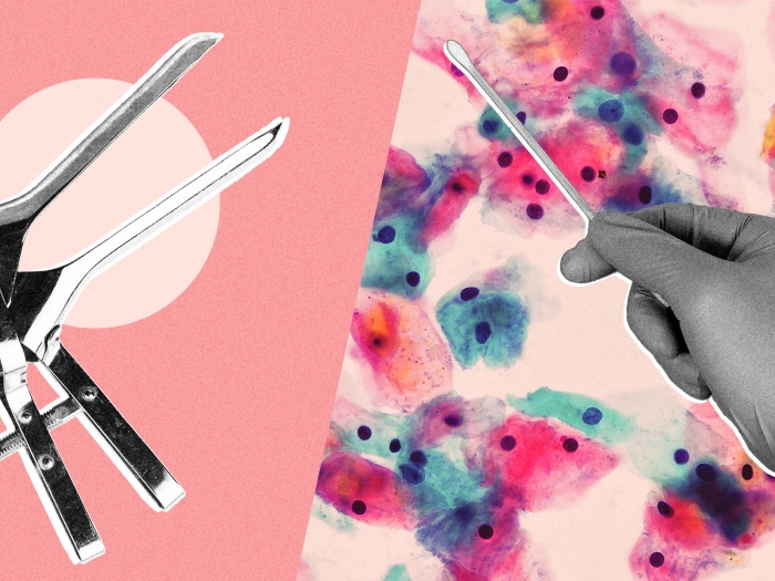 gynecology hand with swab 