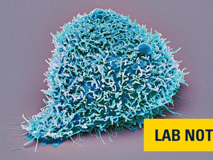 blue kidney cancer cell microscopic 