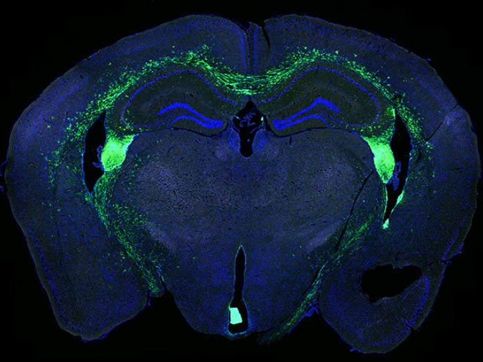 brain stem blue green slice