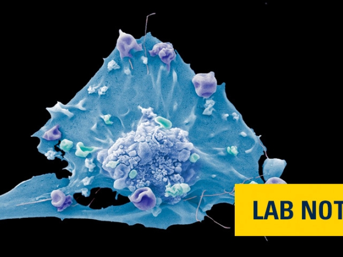 blue breast cancer cell image withia yellow badge saying lab note in blue font