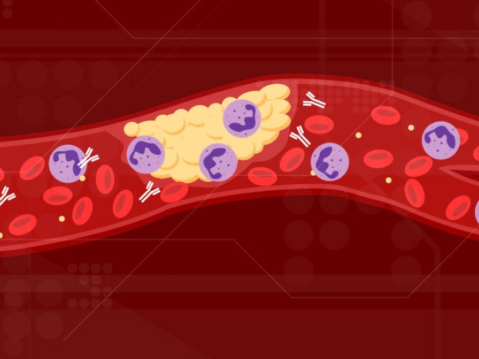 red blood vessel with purple clot and antivodies floating inside