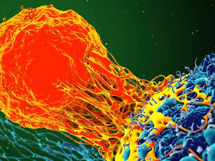 cancer cell in orange under microscope