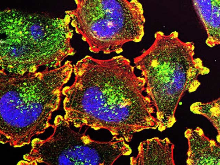 Multi color of microscopic Cancer cells