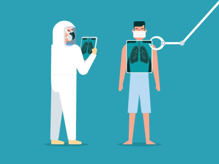 Coronavirus scanning lungs