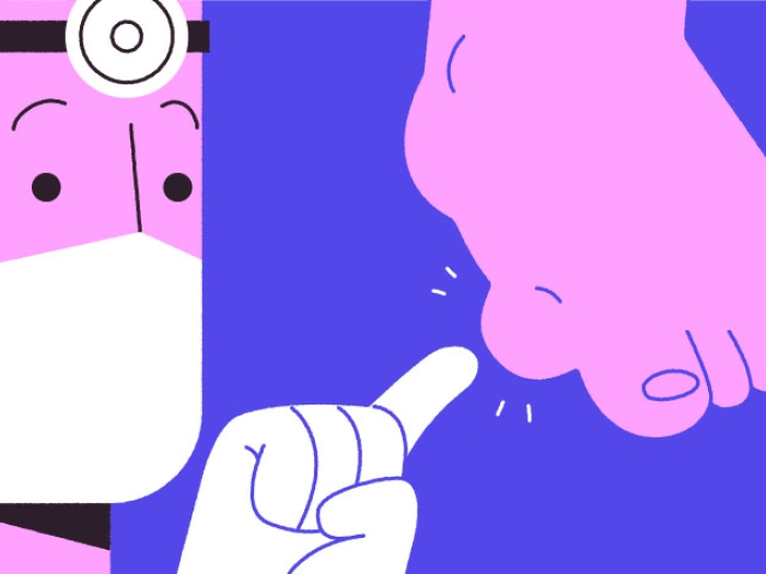 Doctor wearing white glove pointing at the gout on side of foot