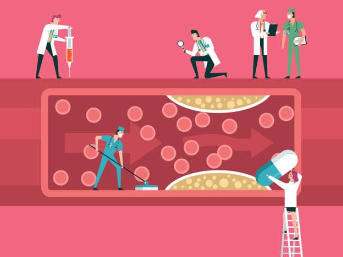 Doctors trying to unclot a clogged artery 