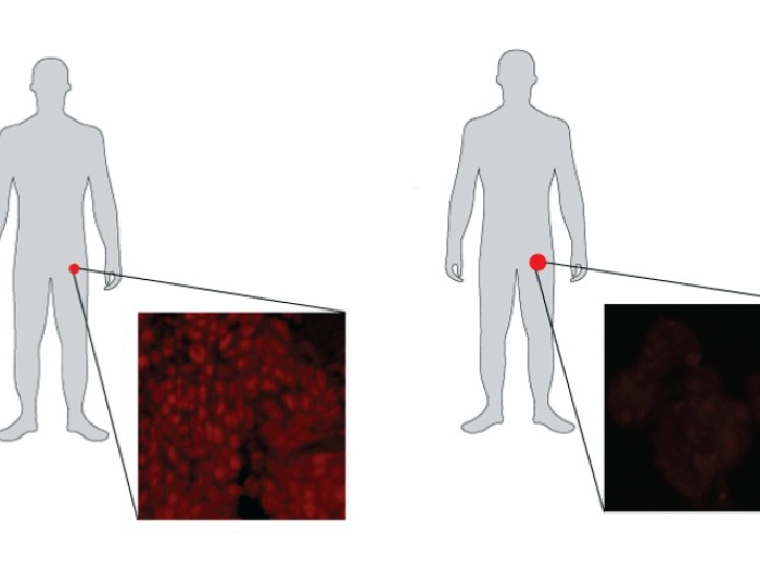 human silhouette groin zoom prostate 
