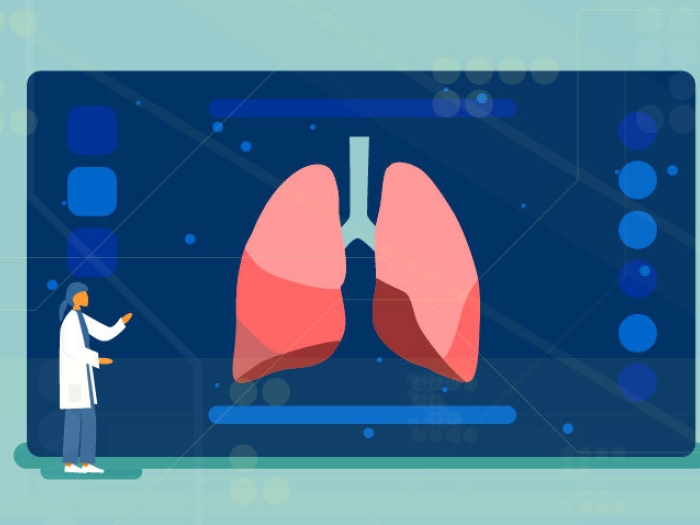 image of lung cancer scanning graphic image