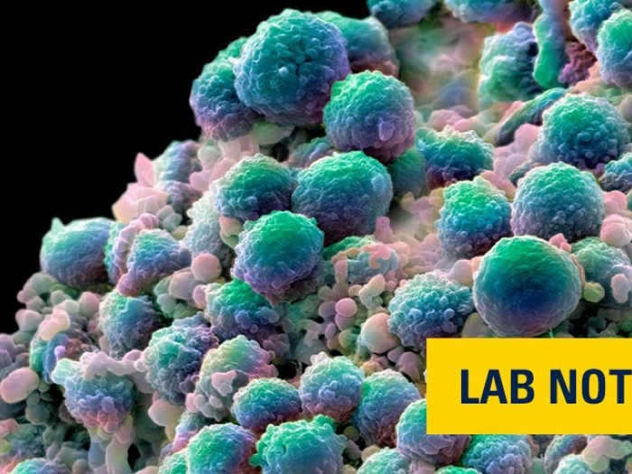 teal microscopic cell prostate cancer