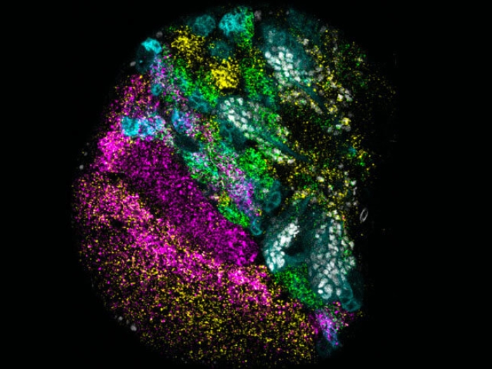 Microscopic image of developing fruit fly brain lobes.