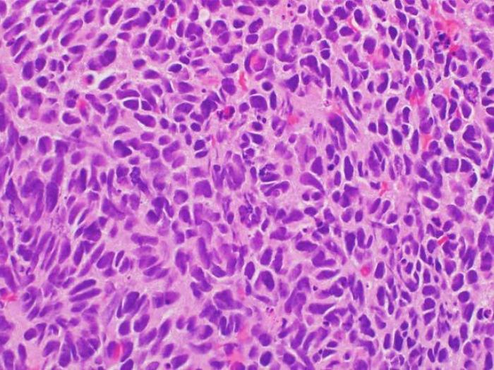 pink purple spongy tissue under microscope view