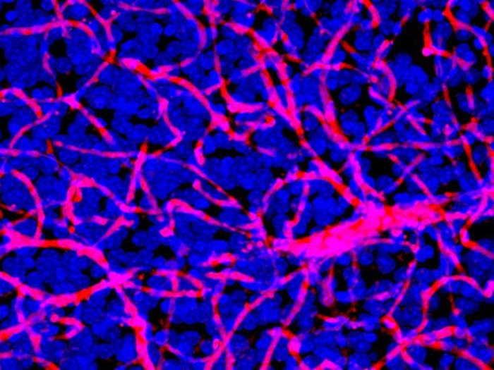 Red pink blue abstract of branches from cells