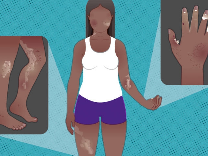 woman standing with close up of hand and legs with skin coloration on each