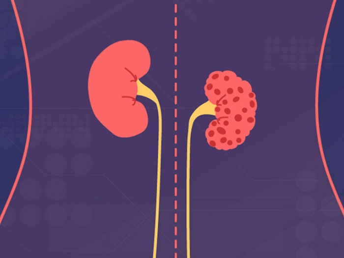 Image of kidneys