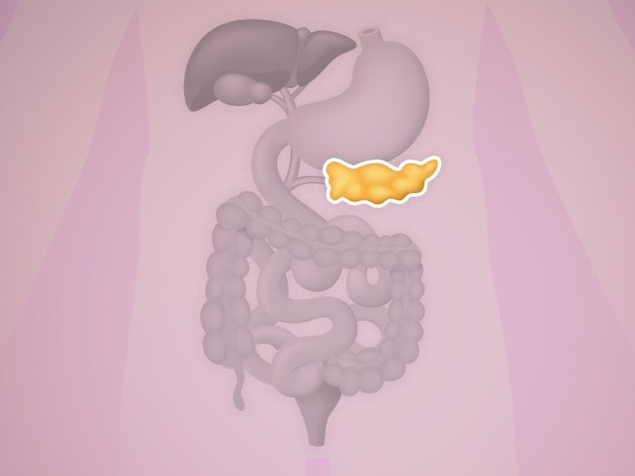 Graphic showing potential pancreatic cancer