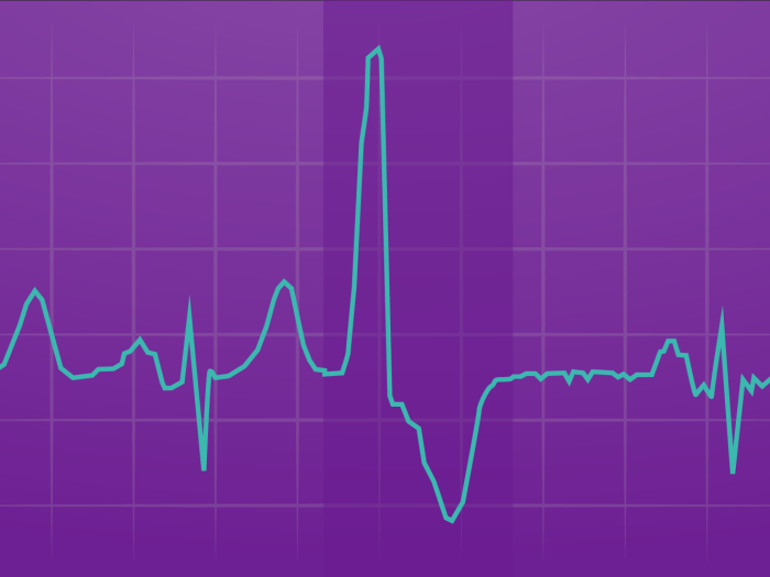 Illustration of an EKG printout showing premature ventricular contractions