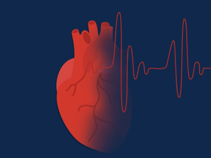 Graphic of a heart with atrial fibrillation