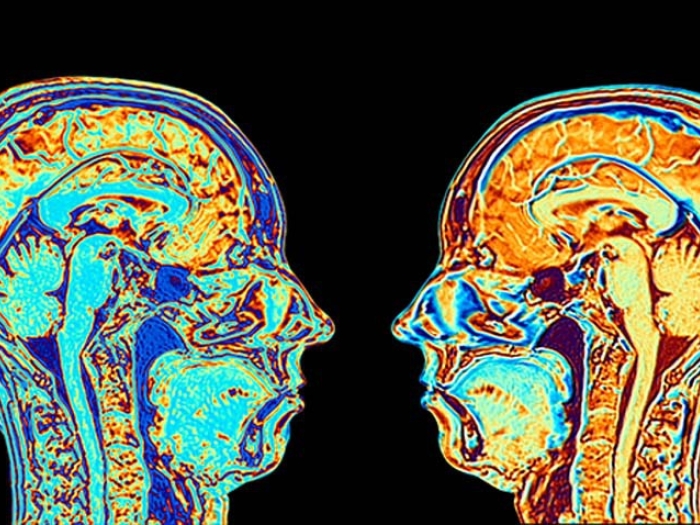 two colorful brain scans