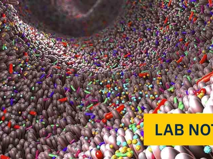 colorful cells in intestine with yellow badge bottom right corner saying lab note in blue
