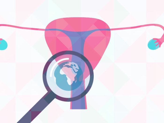 Preventing cervical cancer globally