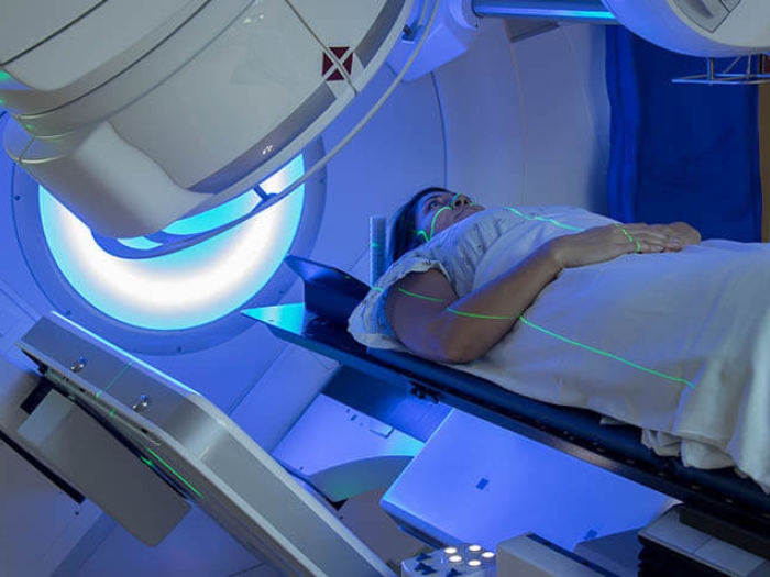 Radiation therapy of young women breast cancer