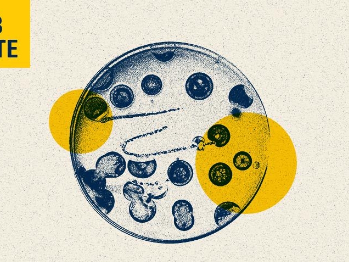 Bacteria in Petri dish