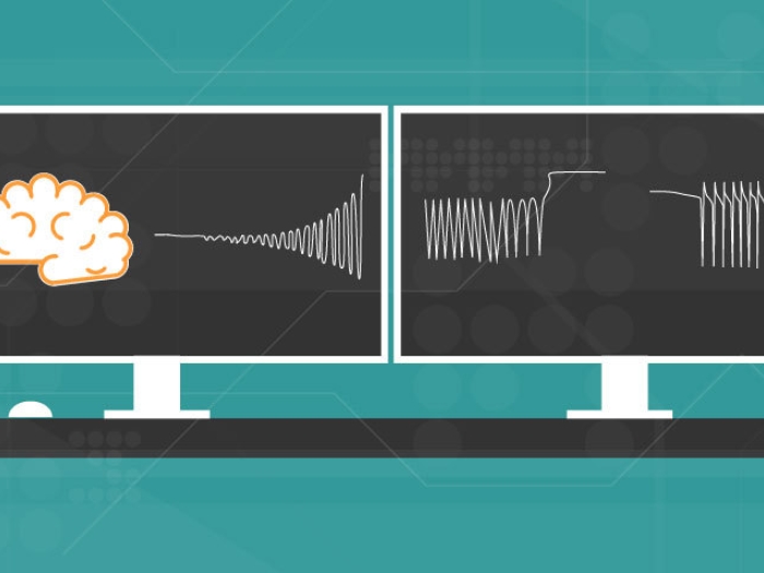 two computers showing a brain and scans