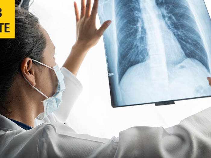 women doc looking ay xray up on bright board