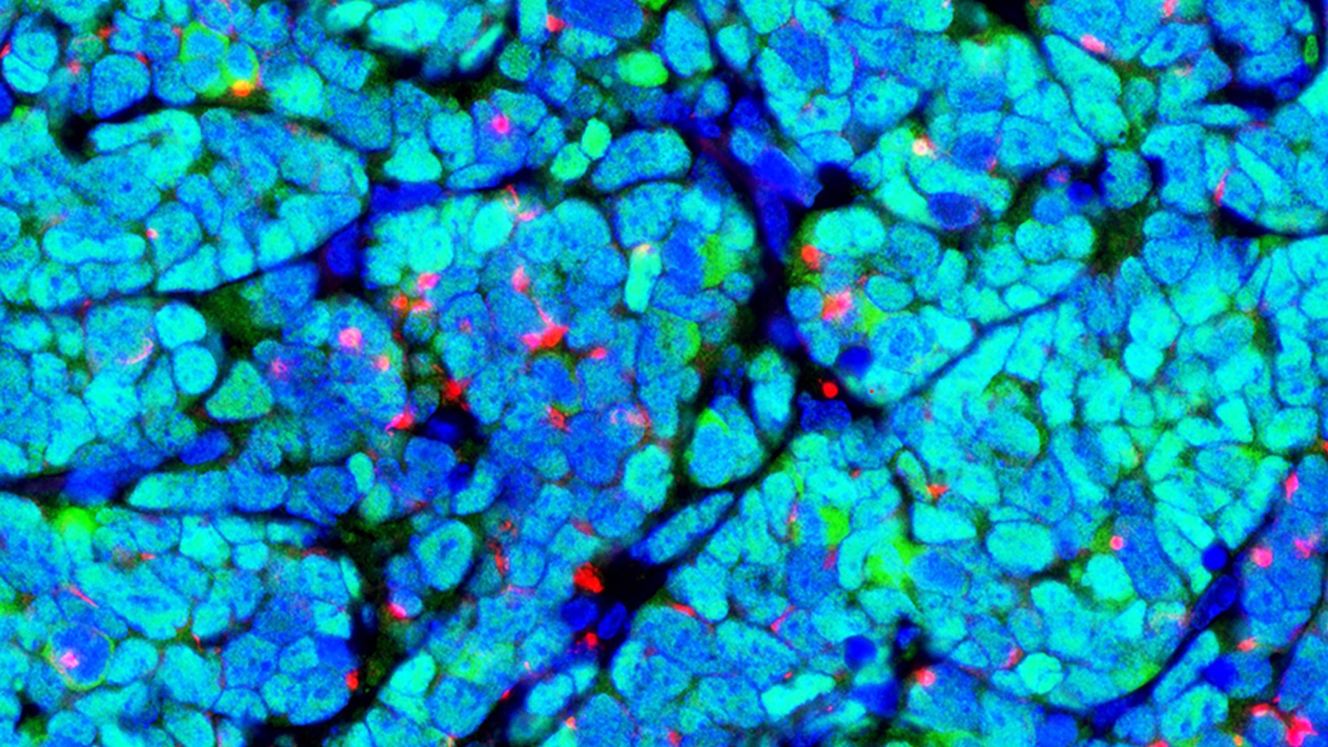 Blue and green cells with red, orange and yellow dots