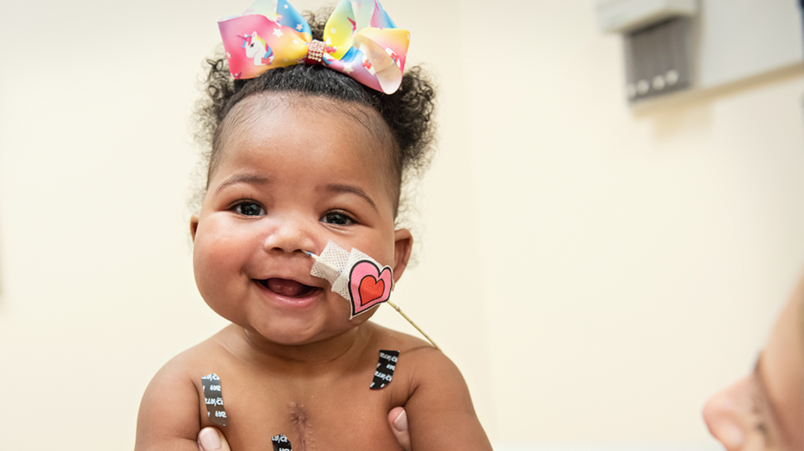 Baby who has had heart surgery